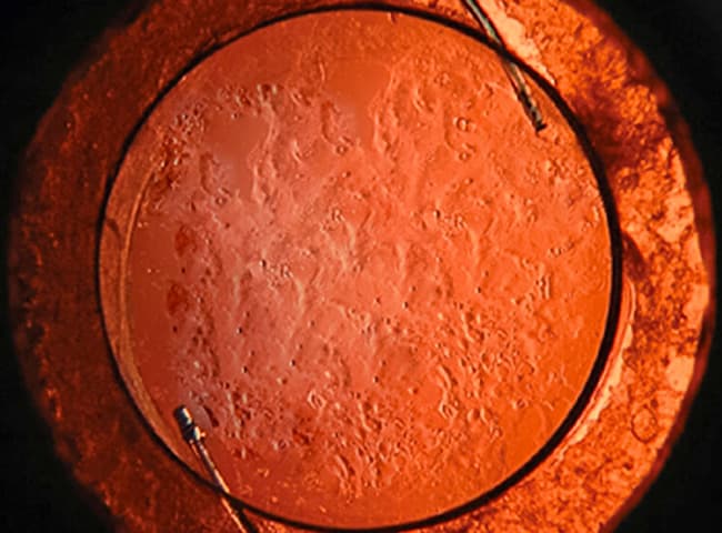 patologia oculare,malattie degli occhi,patologie,vista,cecità,cieco,invecchiamento